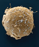 © GETTY IMAGES/OF SCIENCE EYE. SPERM FERTILISING AN OVUM