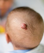 © yasming/istockphoto.com