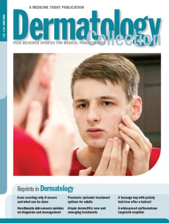 Dermatology Collection - Vol 9 No 1